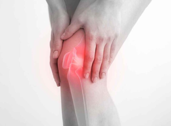 dolore alle gambe: i sintomi di un menisco rotto