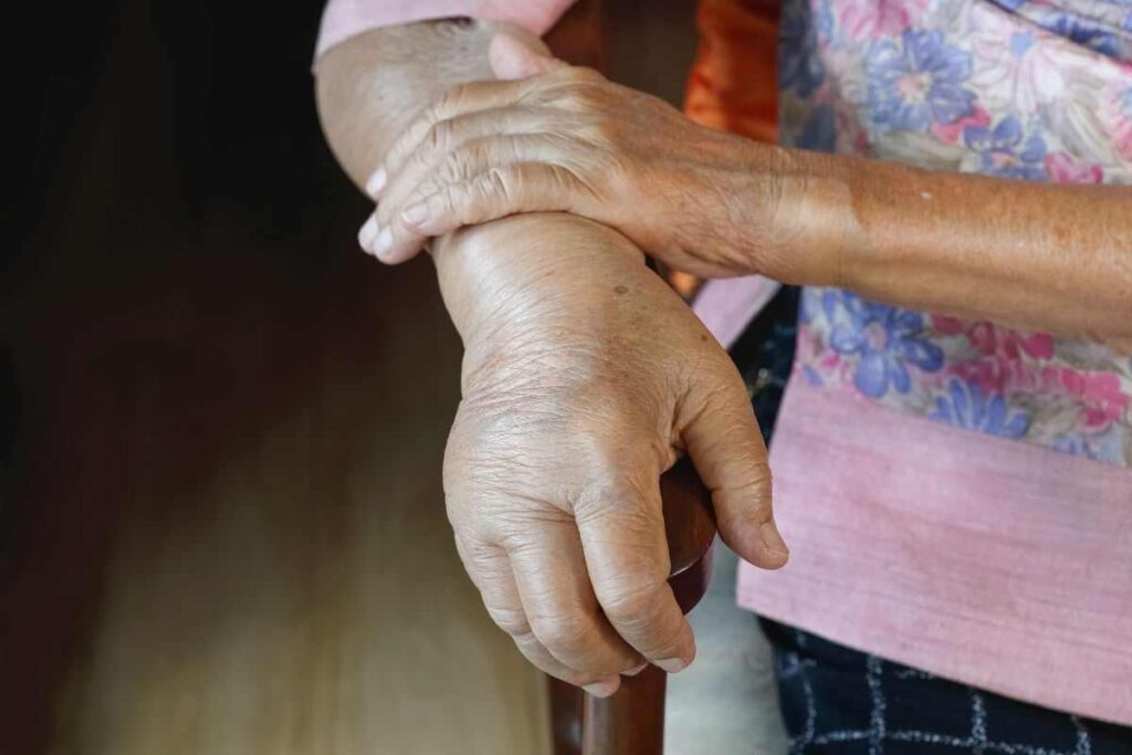 mani sempre gonfie: potrebbe essere sintomo di scompenso caridaco