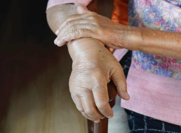 mani sempre gonfie: potrebbe essere sintomo di scompenso caridaco